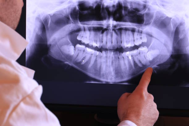 Best Tooth Pain Emergency Relief  in Mayo, MD