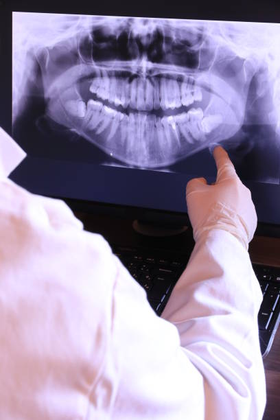 Best Chipped Tooth Repair Near Me  in Mayo, MD